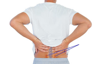 Conditions-Sacroiliac-Joint-Pain-by-Santa-Ana-Pain-Clinic-1-1